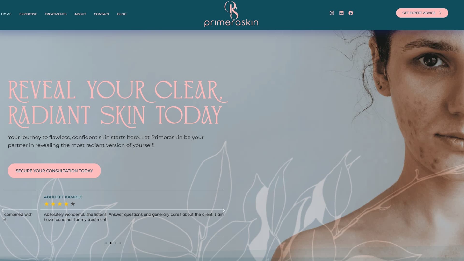 PrimeraSkin website homepage with the heading Reveal Your Clear, Radiant Skin Today and a Secure Your Consultation Today button.